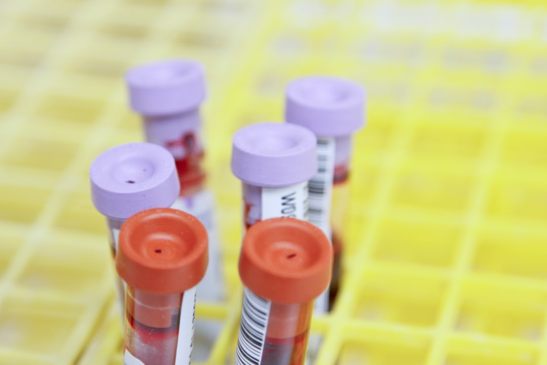white and red plastic blood sample tubes